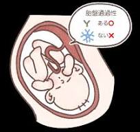 フリー素材】「免疫グロブリンの胎盤通過性」のイラスト ...